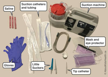 Supplies for tracheostomy suctioning - a manual syringe, suction catheters and tubing, a suction machine, saline nebules and a mask and gloves to protect the caregiver from droplets