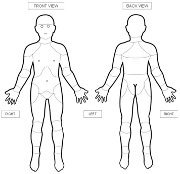 Body diagram to allow child pinpoint pain