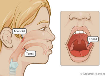 Location of adenoid and tonsil