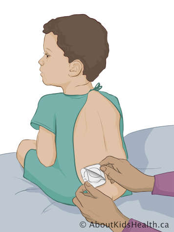 Applying topical anaesthetic patch to child’s lower back