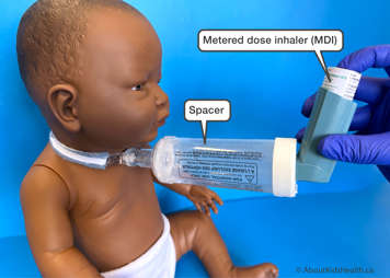 A spacer for a tracheostomy tube used to give medications with a metered dose inhaler attached to a child