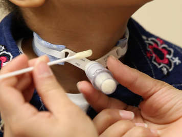 Using a cotton swab to clean the skin around a tracheostomy tube.