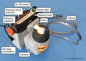 A suction machine with labels for the canister, tubing, filter, pressure gauge and regulator, battery level, power light, AC plug and on and off switch