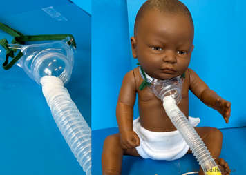 child with a tracheostomy mask and an inset showing a close up of a tracheostomy mask