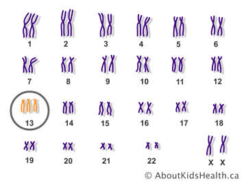 Les paires de chromosomes d’une femelle avec une copie supplémentaire du chromosome 13