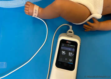 An oxygen saturation monitor on a child's foot showing accurate readings