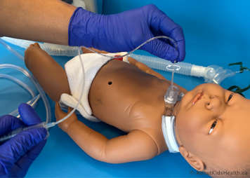 Twirling the tracheostomy suction catheter