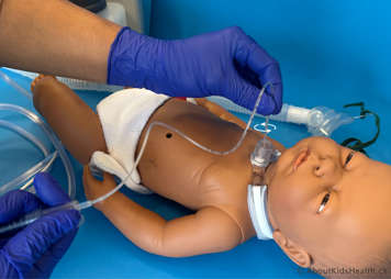 Twirling the tracheostomy suction catheter