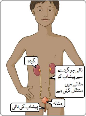  ایک لڑکے میں گردے، پیشاب کی نالی، مثانہ اور مثانہ سے پیشاب کے اخراج کی نالی کا مقام