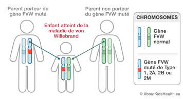 Les chromosomes d’un parent porteur du gène FVW muté, un parent non porteur, et un enfant avec la maladie de von Willebrand