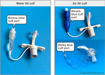 water fill cuff vs air fill cuffs